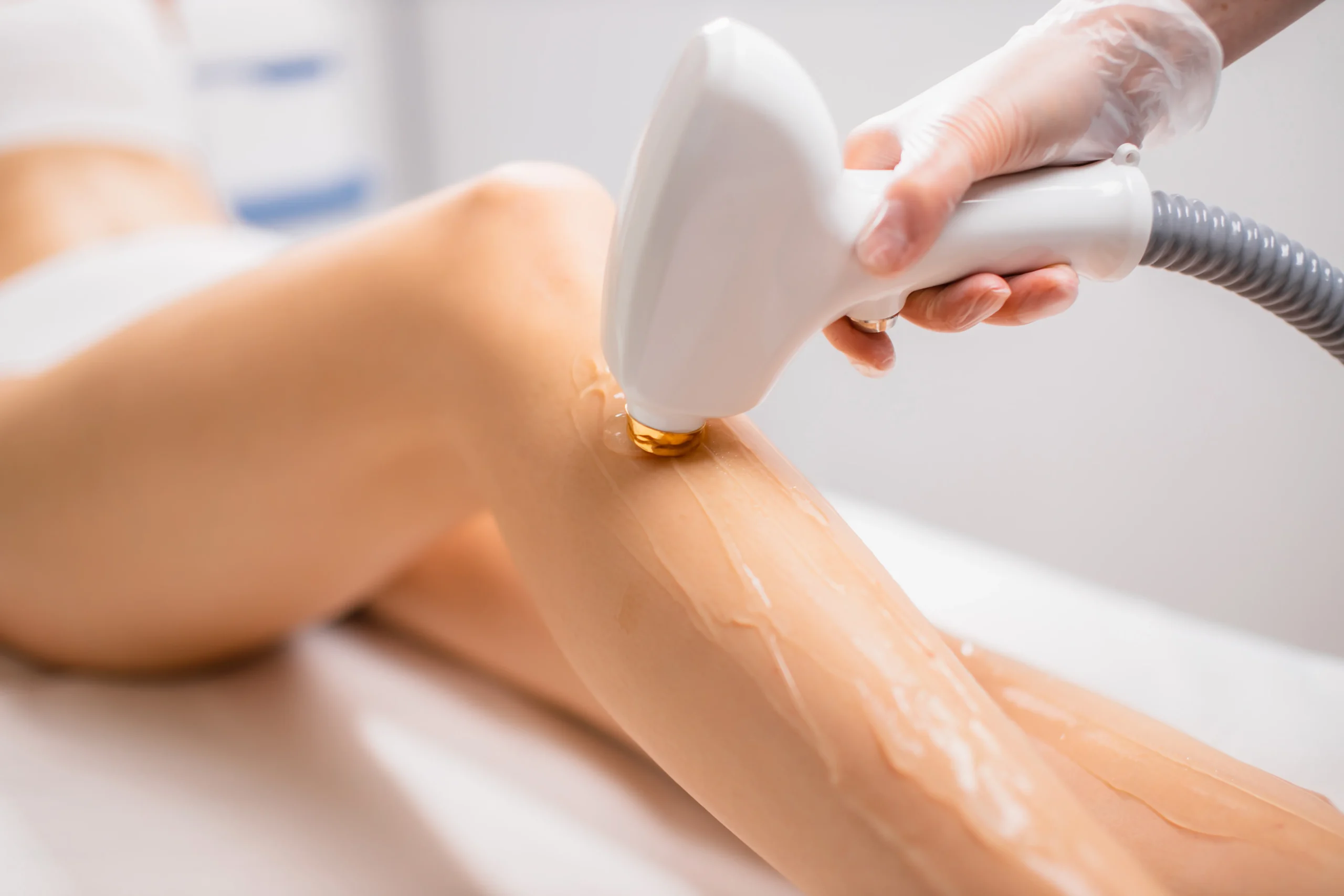 epilation laser meaux